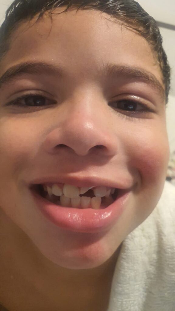 saúde bucal infantil trauma